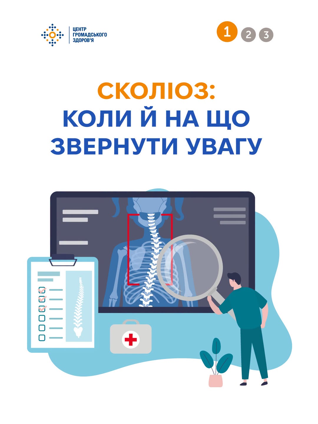 Сколіоз: коли й на що звернути увагу